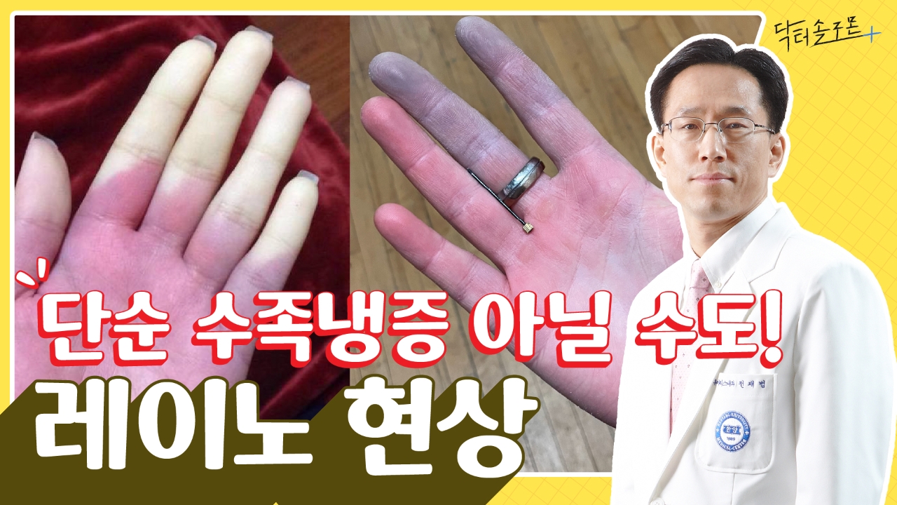 추운 날 손, 발가락 색 변하면 혹시? 원인질환 꼭 살펴야 하는 레이노 현상